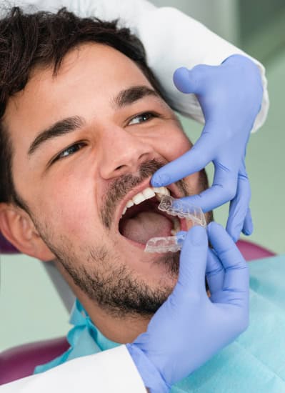 Invisalign for Adults